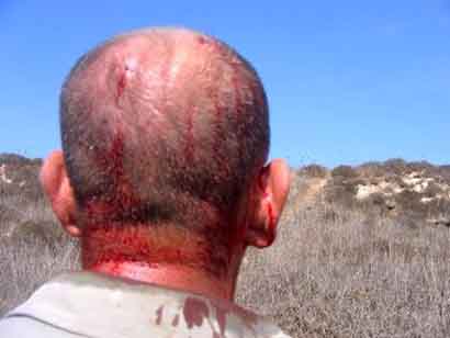Des colons masqués attaquent des cueilleurs d'olives à Tel, près de Naplouse